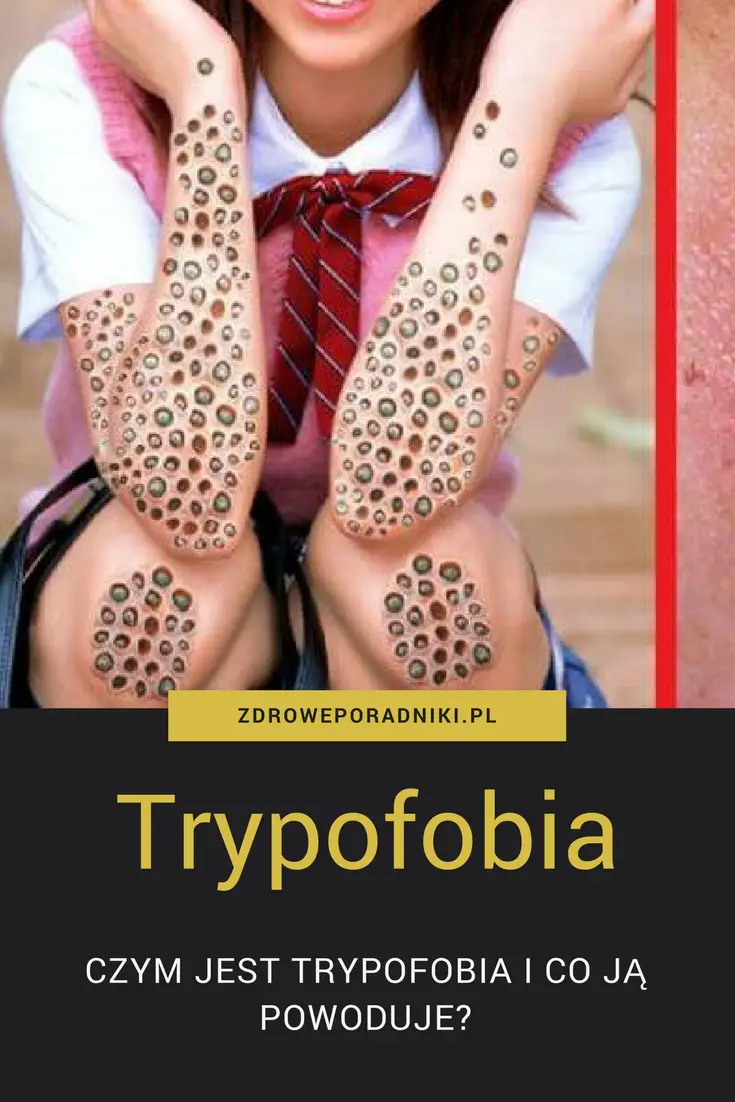trypofobia